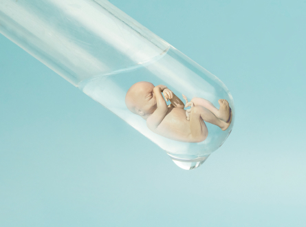 IVF (Test Tube Baby)